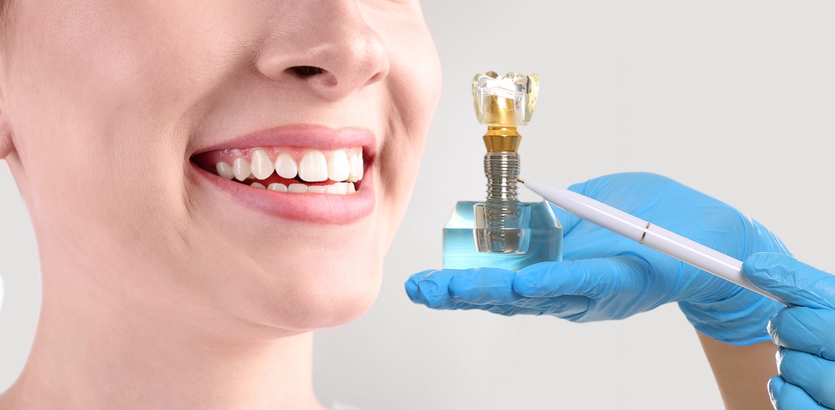 Jaw bone grafting for stronger oral structure at Fatemeh Hadjian in Palm Desert, CA